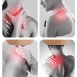 Aparat za masažu vrata